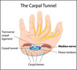 Gamer Wrist RSI Carpal Tunnel Exercises